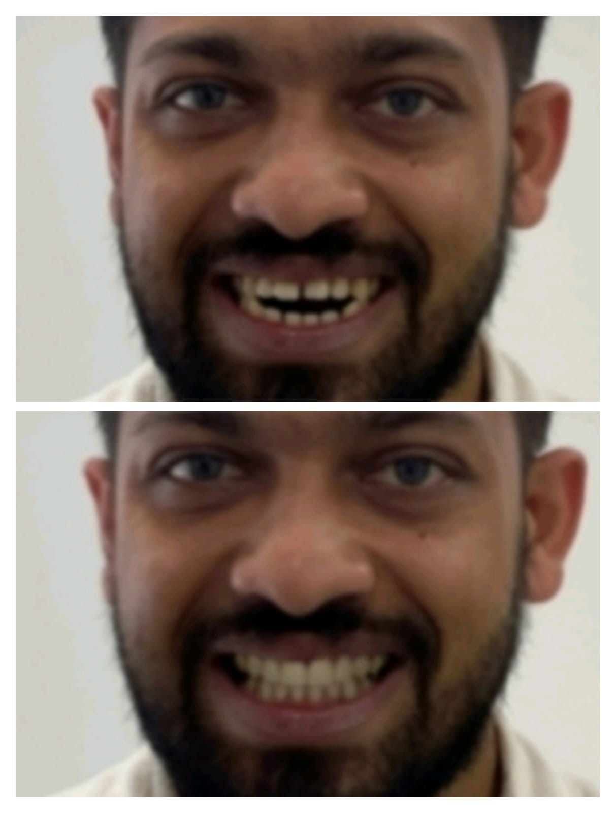 SmileView Simulation