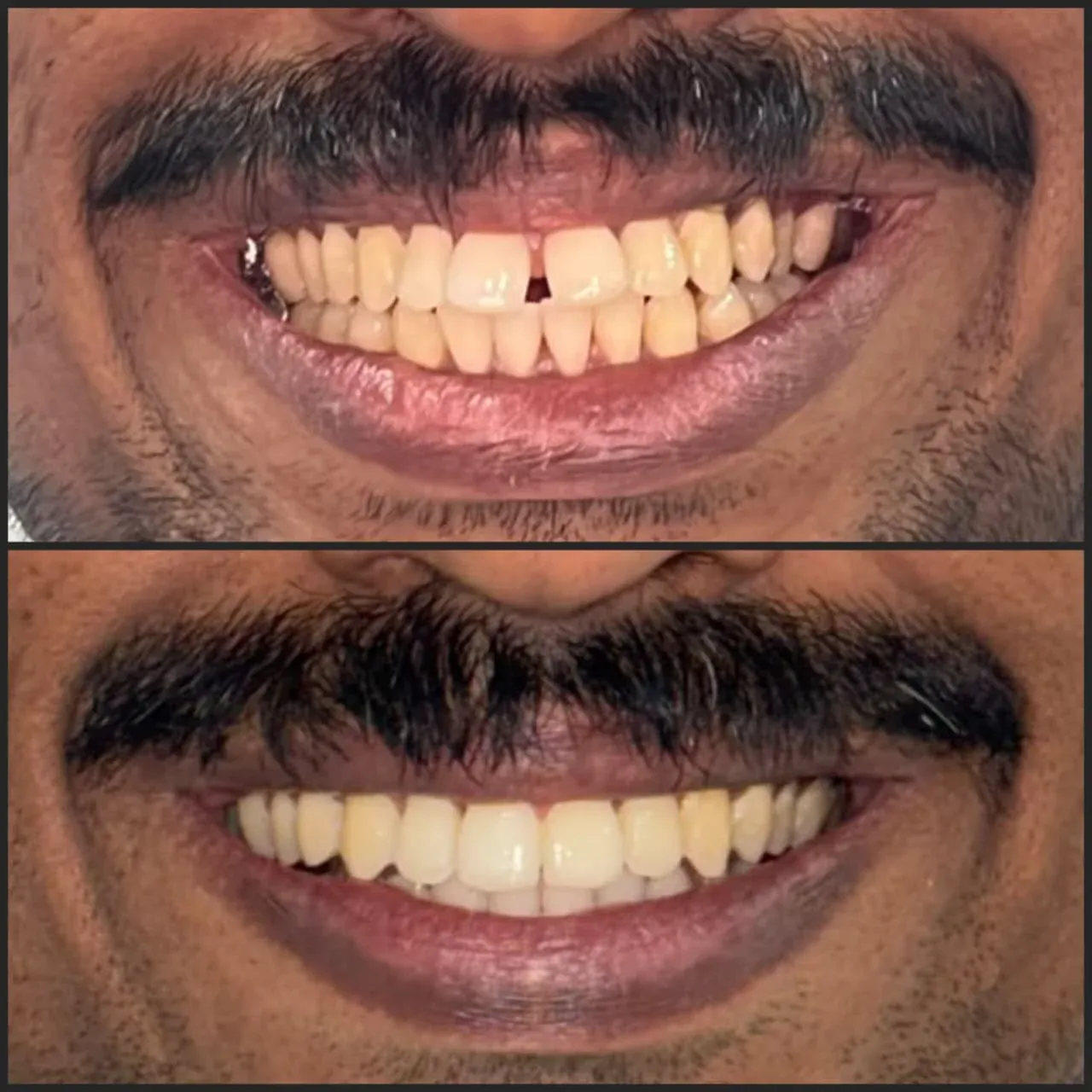 Before & After Results