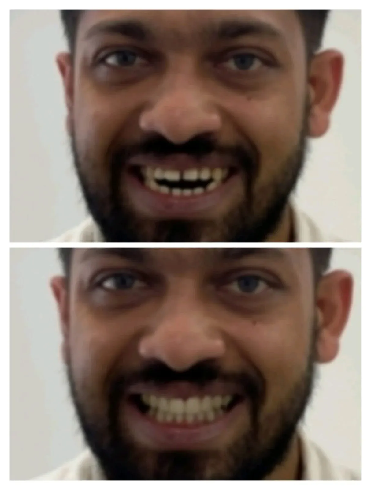 SmileView Simulation